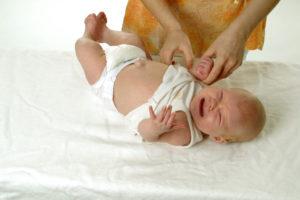 Бандаж для пупочной грыжи для новорожденных детей: показания, правила использования, стоимость