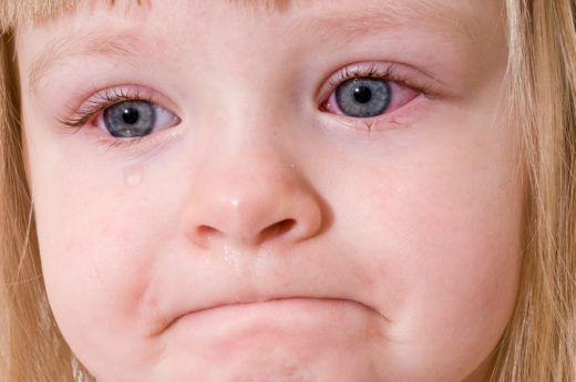 Красные белки глаз у ребенка